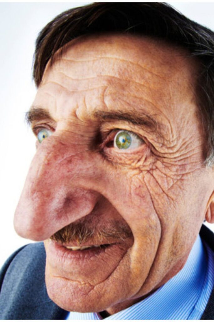 worlds biggest nose